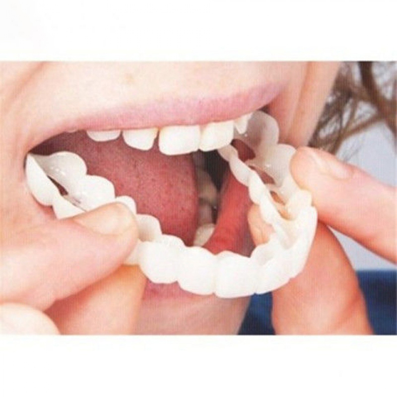 Teeth Whitening Veneers - Penutup Gigi Palsu Cocok Sempurna Pemutih