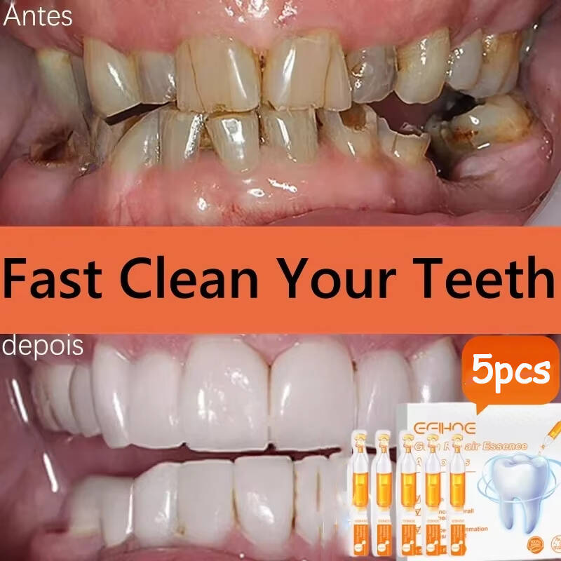 Teeth Whitening With Baking Soda - Serum Perbaikan Cepat Pereda Pertumbuhan Kembali