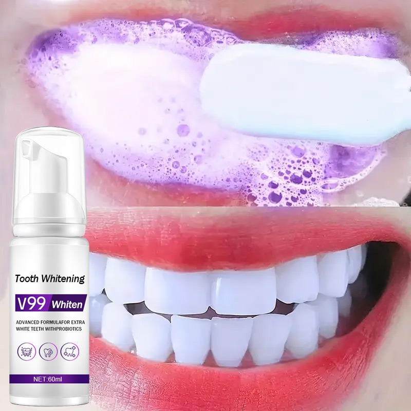 Teeth Whitening Mousse - Mousse V99 pasta gigi pembersih gigi