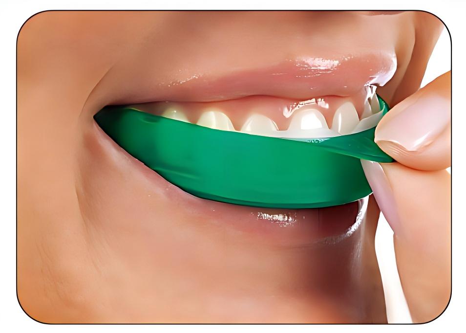 Teeth Whitening Opalescence Go - Ultradent Opalescence Go Strip Pemutih Gigi