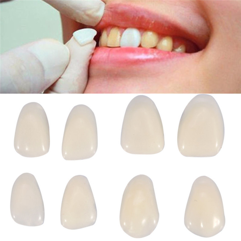 Teeth Whitening Veneers - Gigi Palsu Sementara Mahkota Gigi Veneer