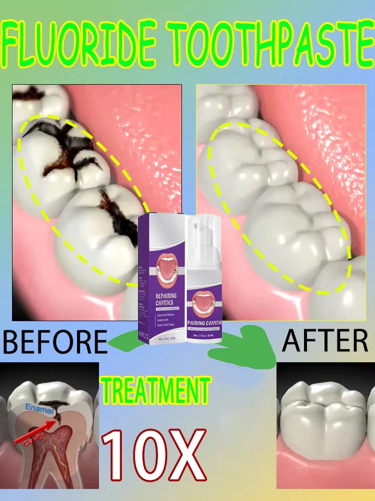 Teeth Whitening Treatment - Penjualan terlaris terlaris, perbaikan ilmiah rongga,