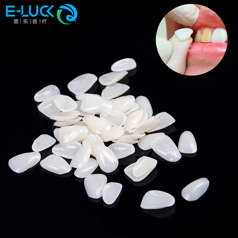 Teeth Whitening Veneers - 50 buah pelapis gigi sementara, mahkota