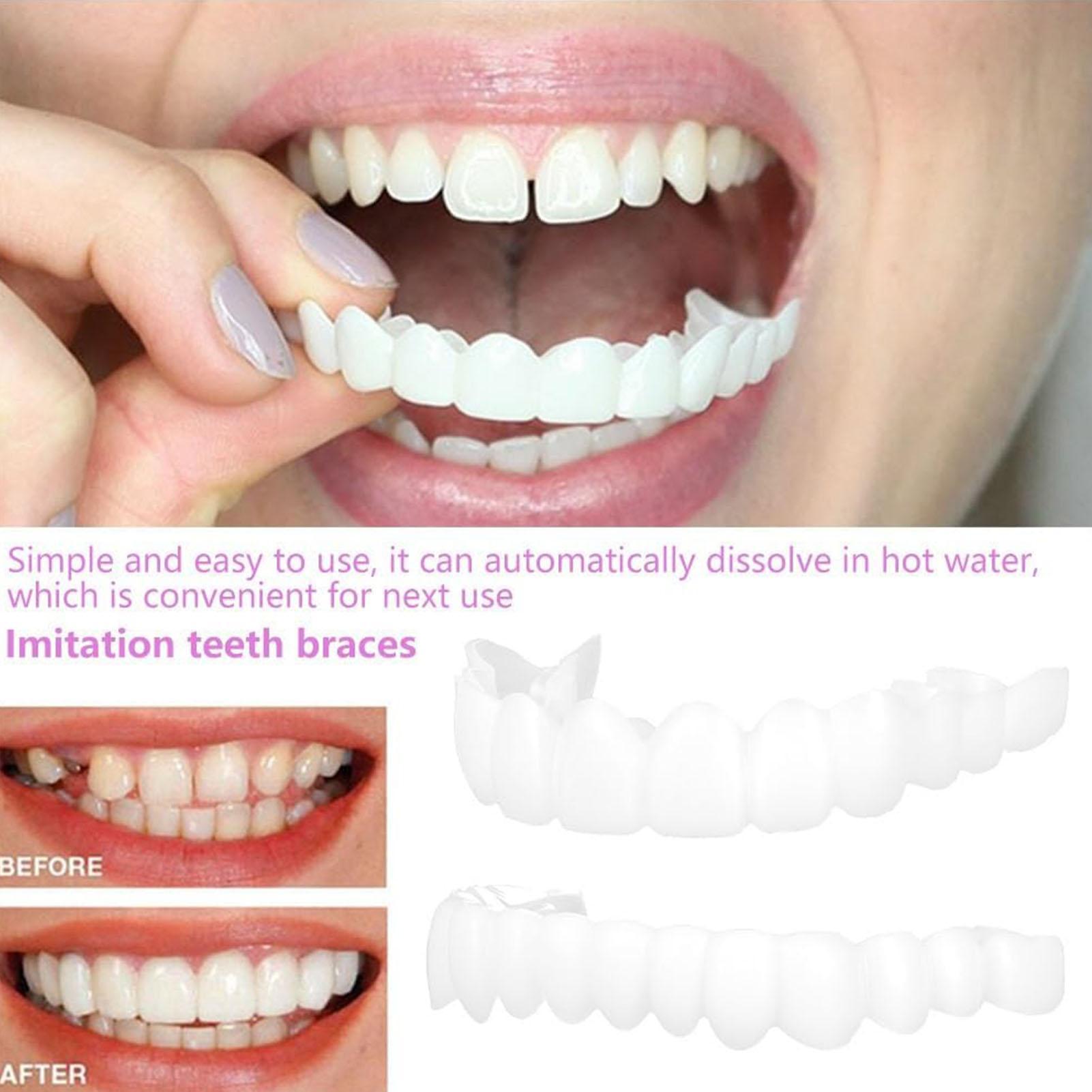 Teeth Whitening Veneers - 2pcs Veneer Gigi Temporer Pria Wanita,