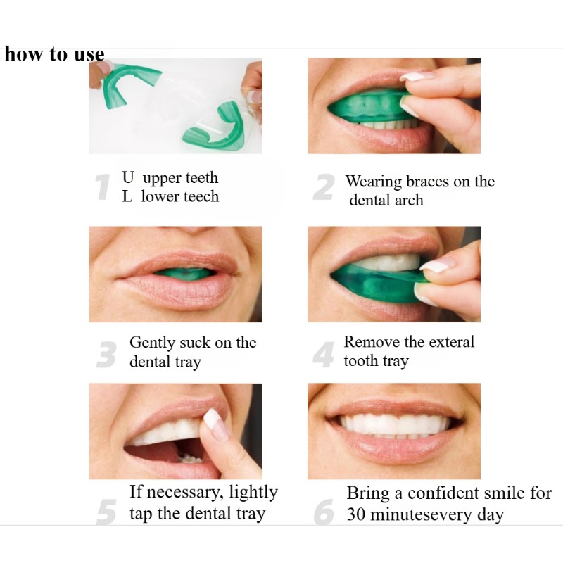 Set Baki Pemutih Gigi Berbentu - Teeth Whitening Quick ulasan dan harga