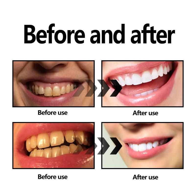 Bubuk Pemutih Gigi Arang / Bub - Teeth Whitening With Baking Soda ulasan dan harga