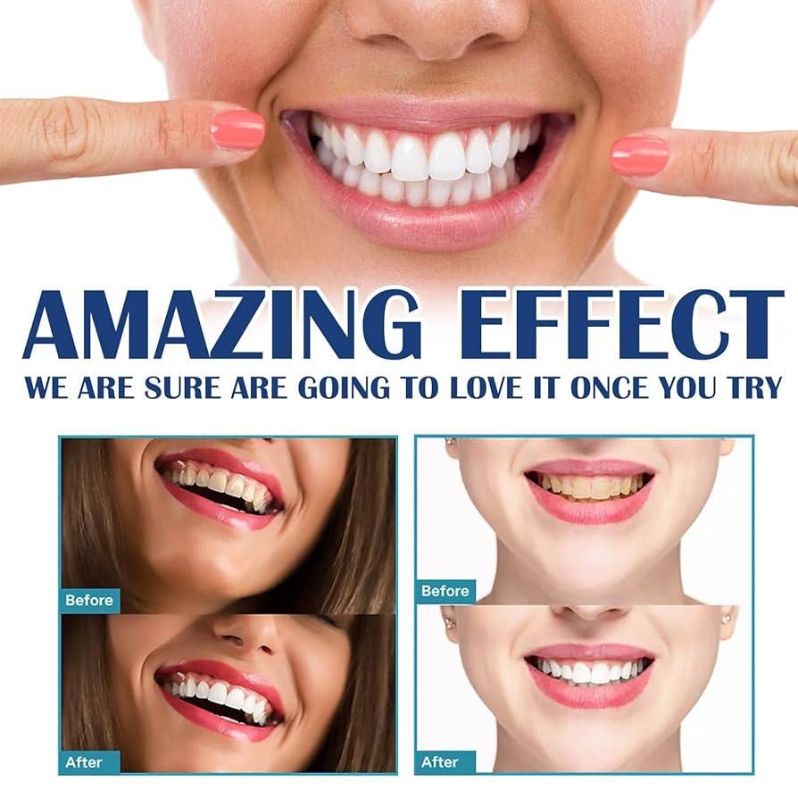 Stiker Pemutih Gigi Gel Pemuti - Teeth Whitening Gel Refills ulasan dan harga