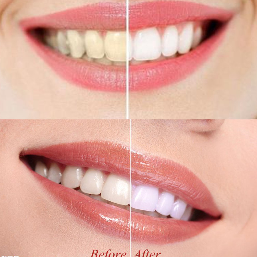 Arang Bambu Gigi Gigi Gigi Gig - Teeth Whitening App ulasan dan harga