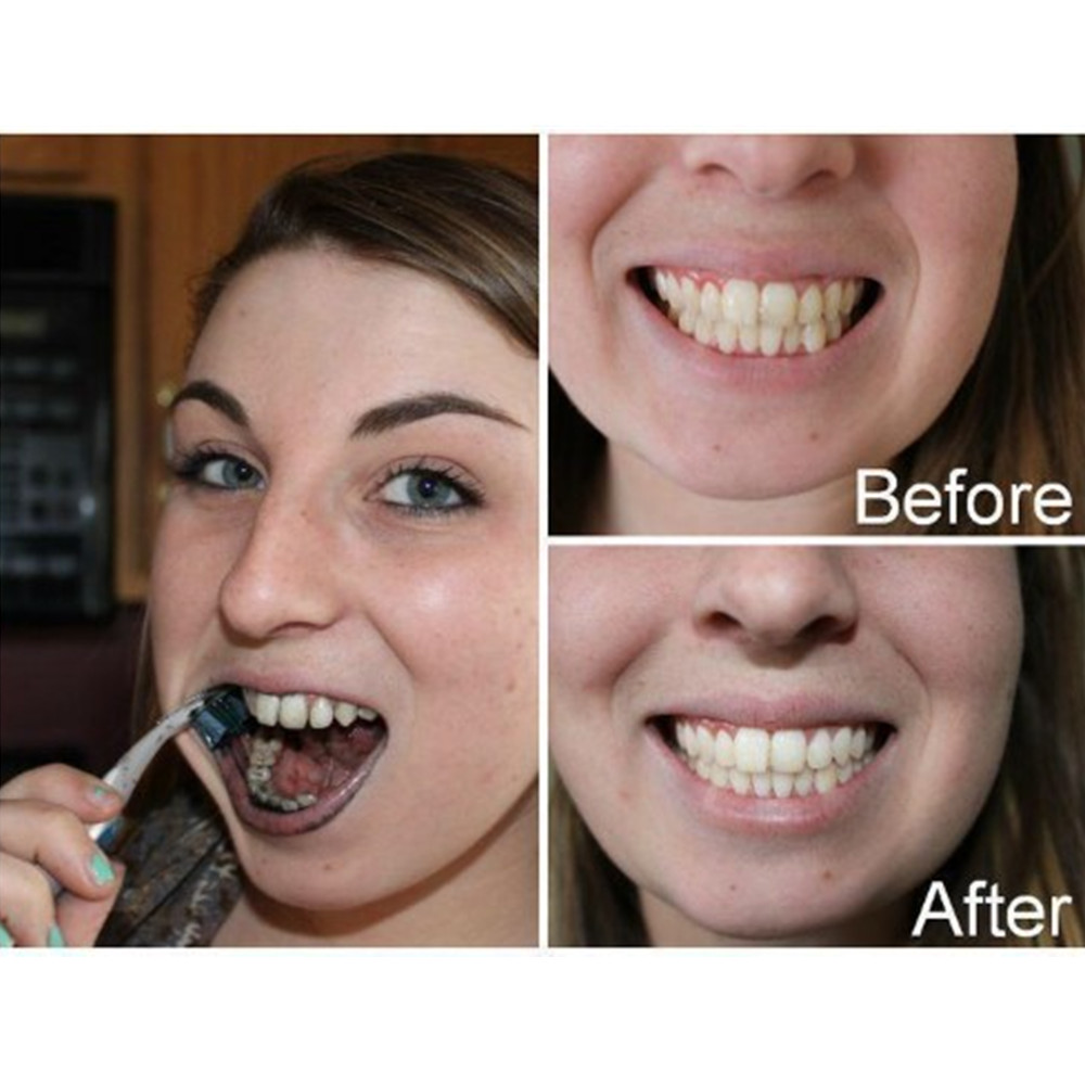Arang Bambu Gigi Gigi Gigi Gig - Teeth Whitening App ulasan dan harga