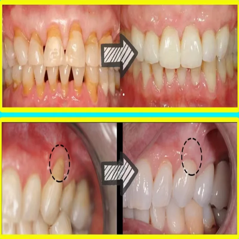 Serum Perbaikan Cepat Pereda P - Teeth Whitening With Baking Soda ulasan dan harga