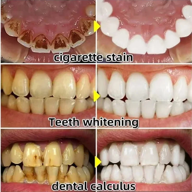 Serum Perbaikan Cepat Pereda P - Teeth Whitening With Baking Soda ulasan dan harga