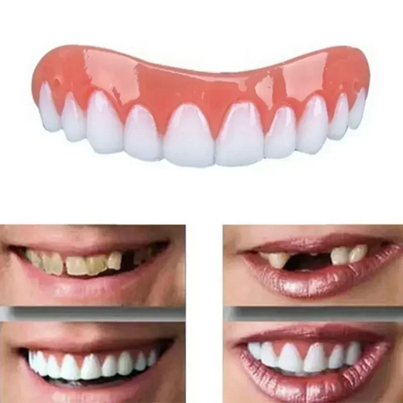 Gigi Palsu Silikon Baru, Venee - Teeth Whitening Veneers ulasan dan harga
