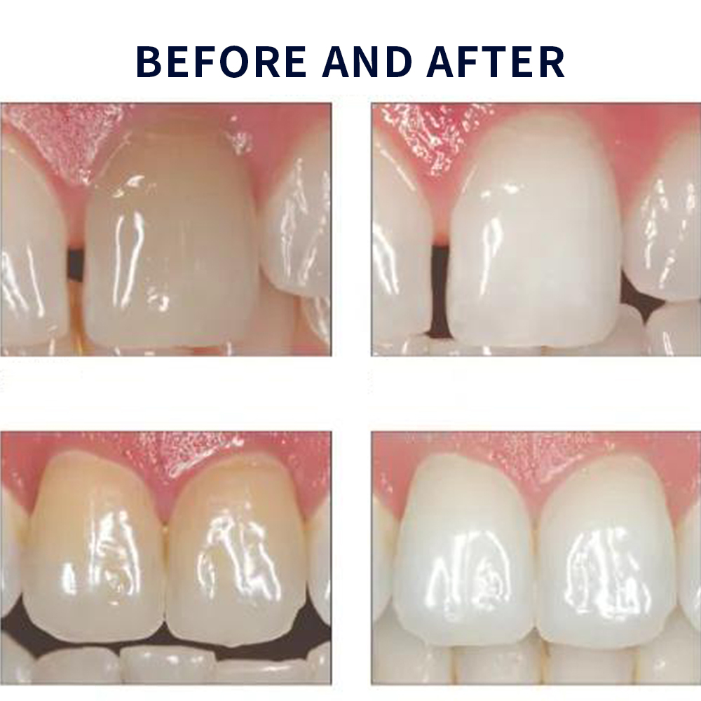 Opalescence Whitening 20% PF 2 - Whitening Mouthwash ulasan dan harga