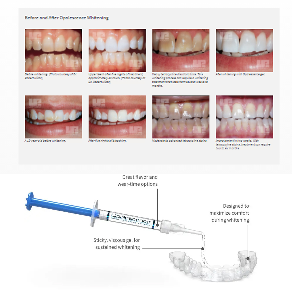 Opalescence Whitening 20% PF 2 - Whitening Mouthwash ulasan dan harga