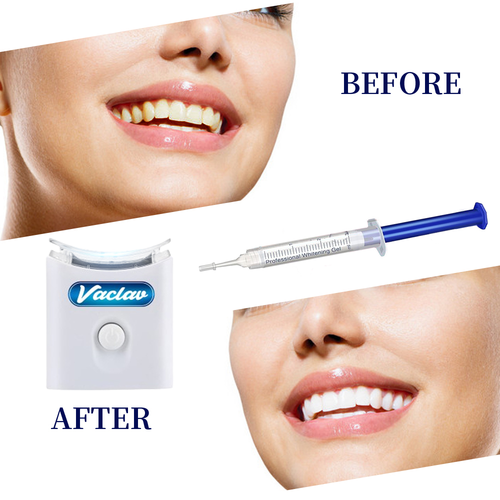 Kit Pemutih Gigi di Rumah deng - Teeth Whitening With Baking Soda ulasan dan harga