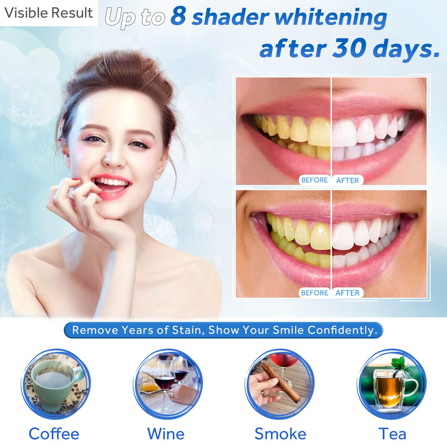 Gel Pemutih Gigi Isi Ulang Syr - Teeth Whitening Gel Refills ulasan dan harga