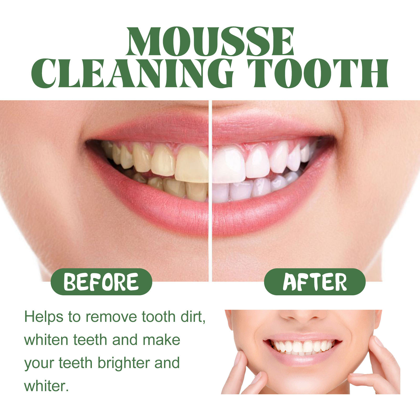 Busa Pemutih Ukuran Perjalanan - Teeth Whitening Mousse ulasan dan harga