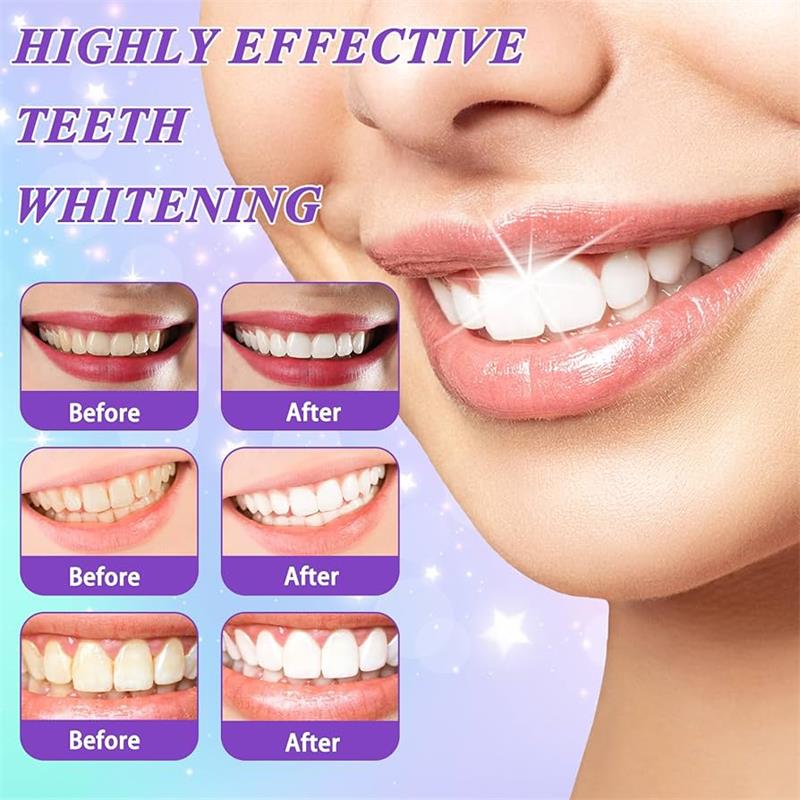 Pasta Gigi Pemutih Gigi Ungu 9 - Teeth Whitening Mousse ulasan dan harga