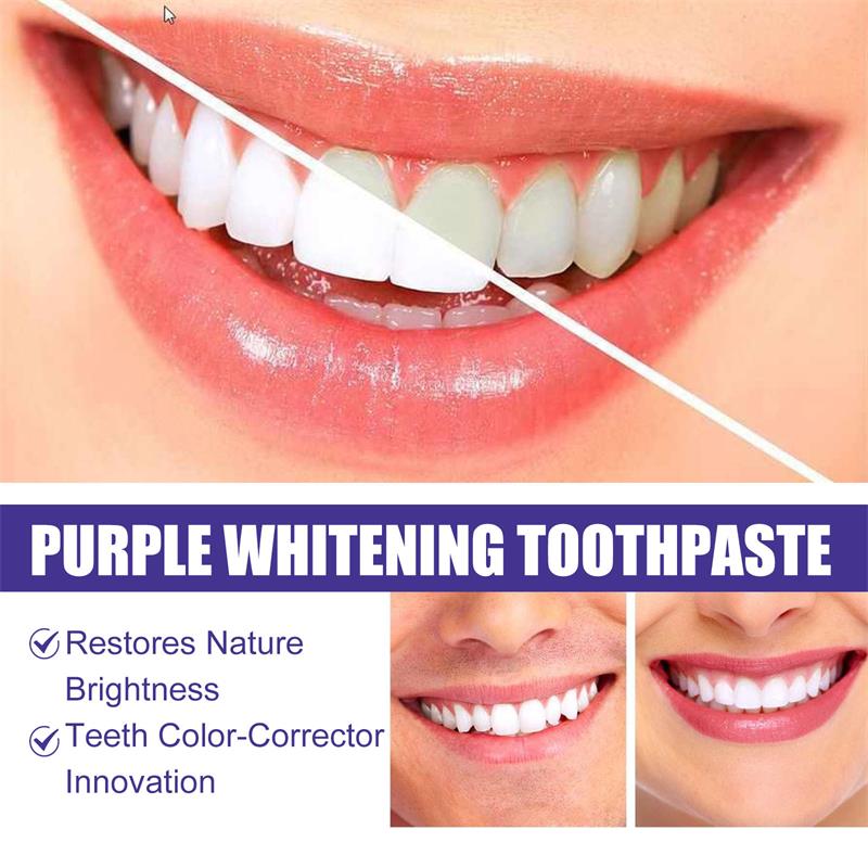 Pasta Gigi Pemutih Gigi Ungu 9 - Teeth Whitening Mousse ulasan dan harga