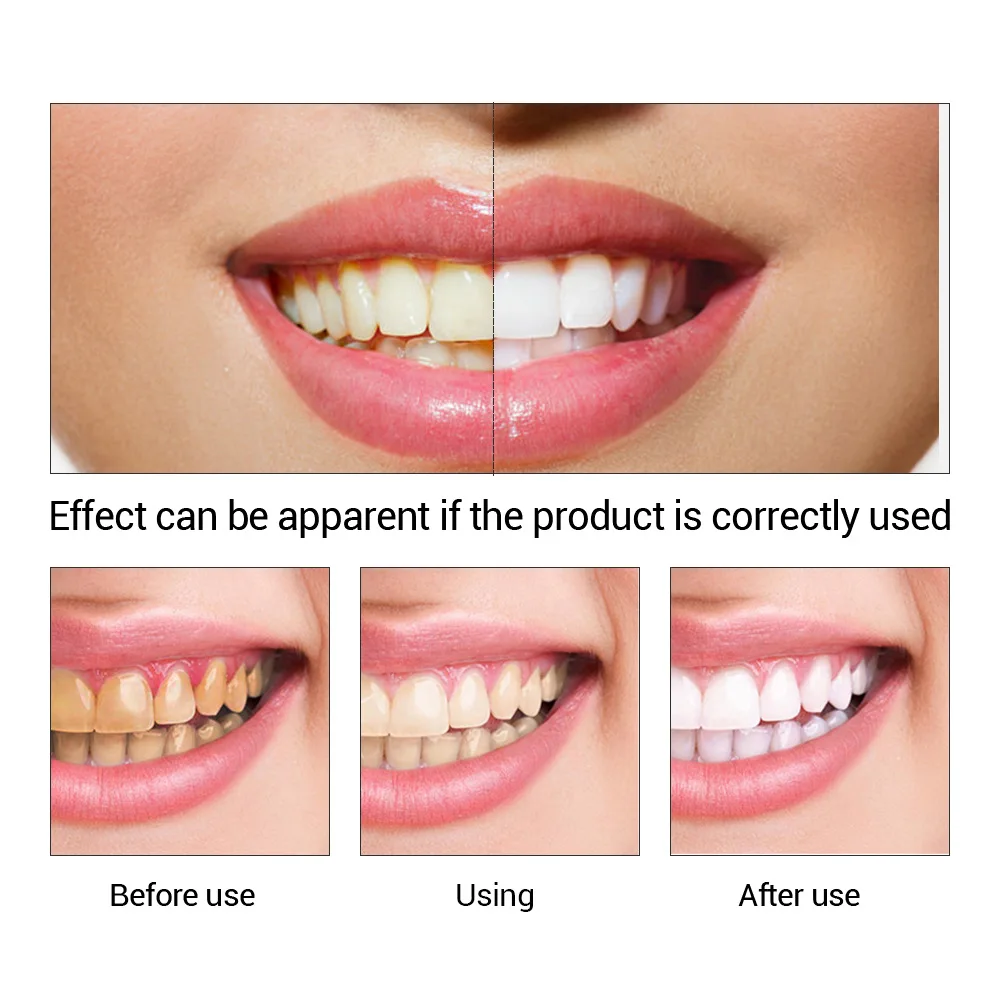FTEENPLY Bubuk Esensi Pemutih  - Teeth Whitening App ulasan dan harga