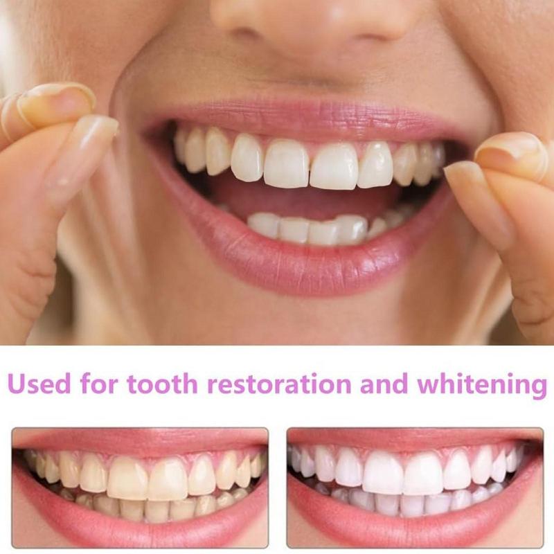 Veneer Gigi Snap On, Veneer Se - Teeth Whitening Veneers ulasan dan harga