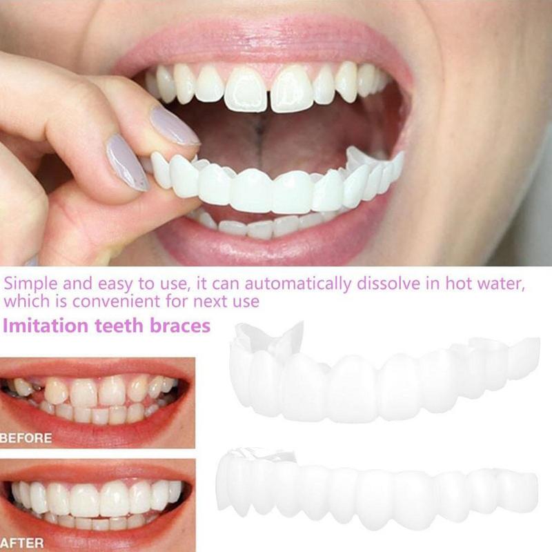 Veneer Gigi Snap On, Veneer Se - Teeth Whitening Veneers ulasan dan harga