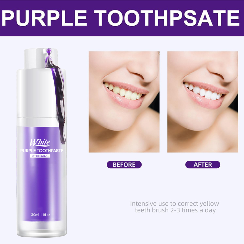 Pasta Gigi Pemutih Ungu 30ml P - Teeth Whitening Treatment ulasan dan harga