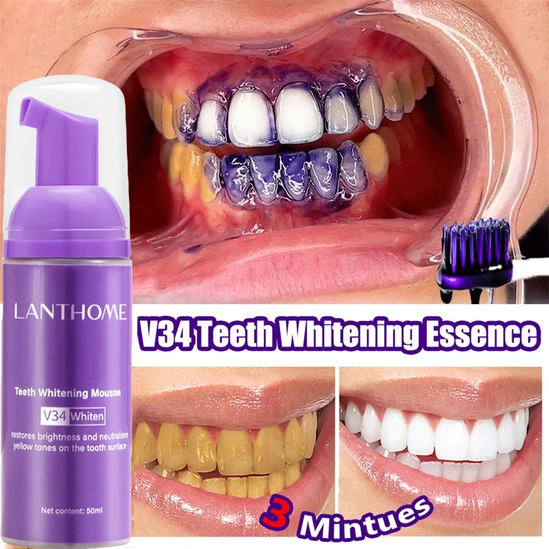 V34 Pasta Gigi Mousse Pemutih  - Teeth Whitening Mousse ulasan dan harga