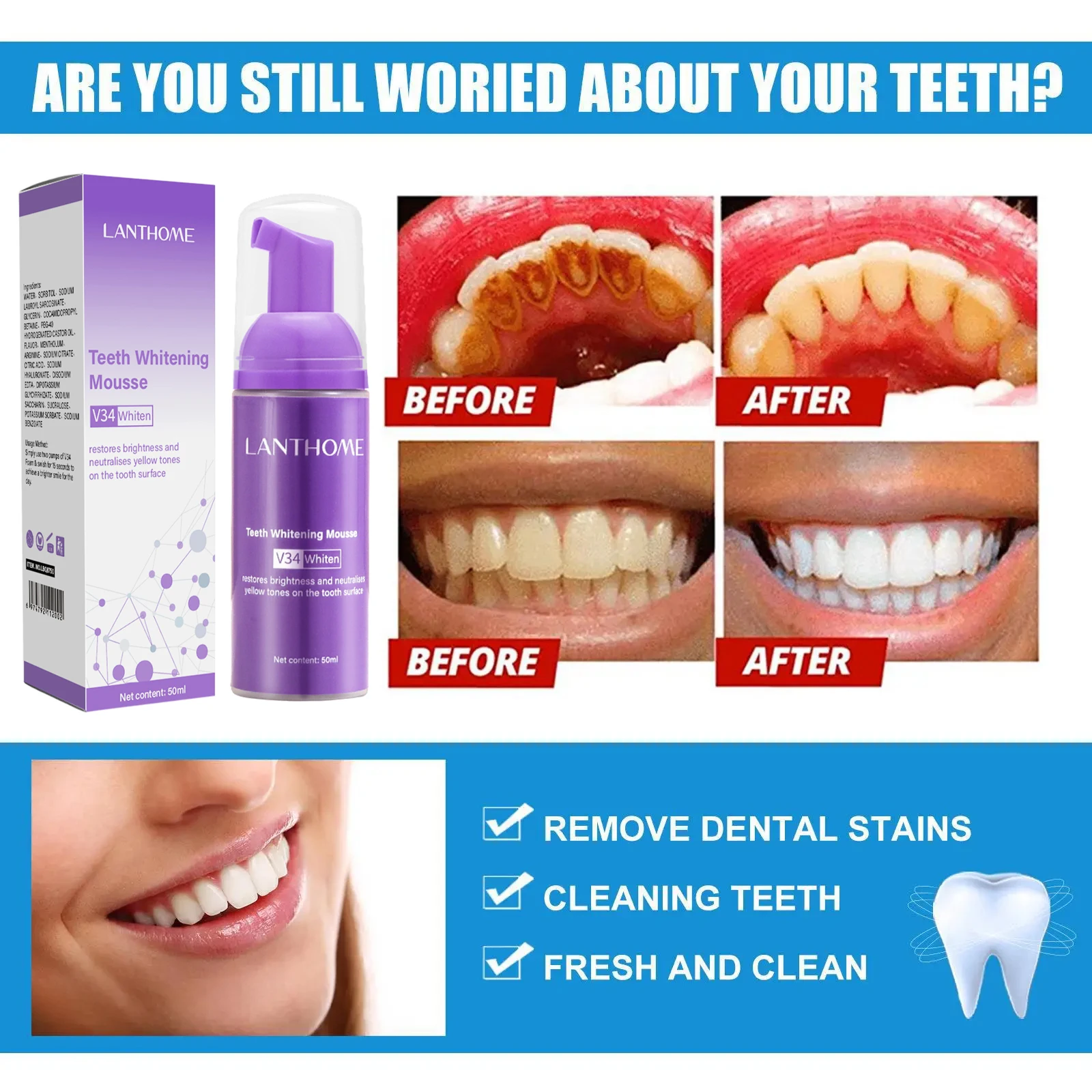 V34 Pasta Gigi Mousse Pemutih  - Teeth Whitening Mousse ulasan dan harga