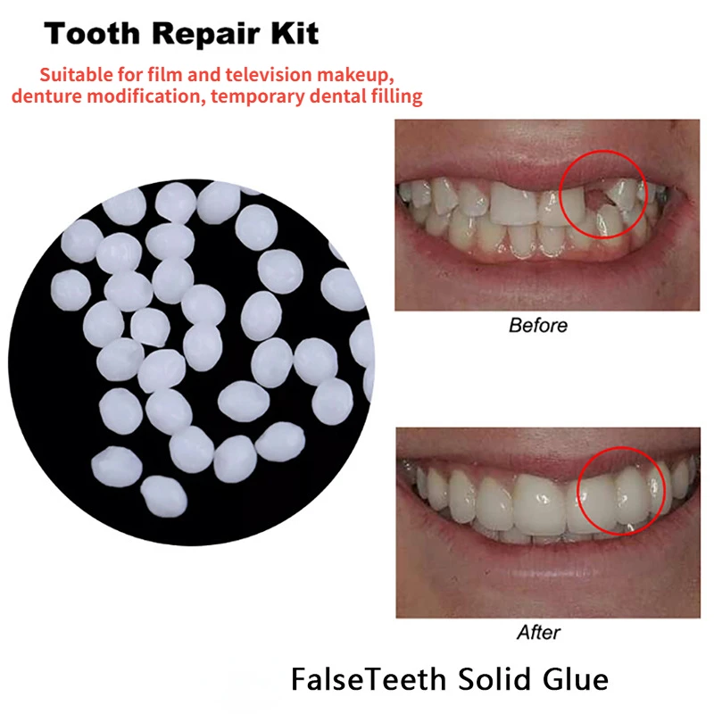 Lem perbaikan gigi dapat membe - Teeth Whitening At Home ulasan dan harga