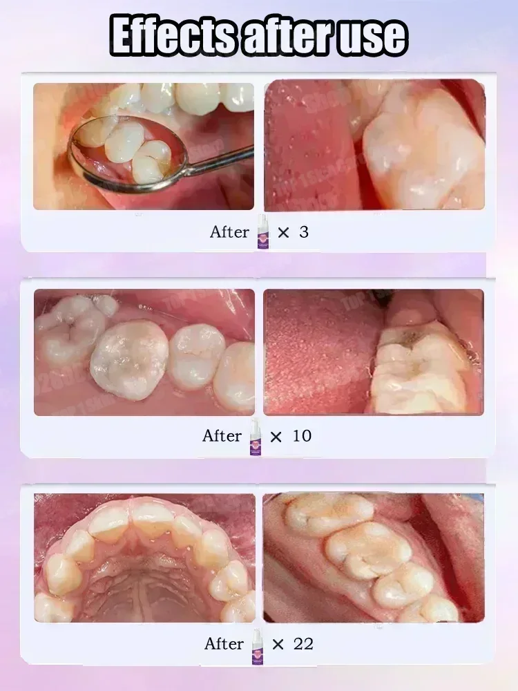 Penjualan Terlaris Terlaris, P - Teeth Whitening Treatment ulasan dan harga