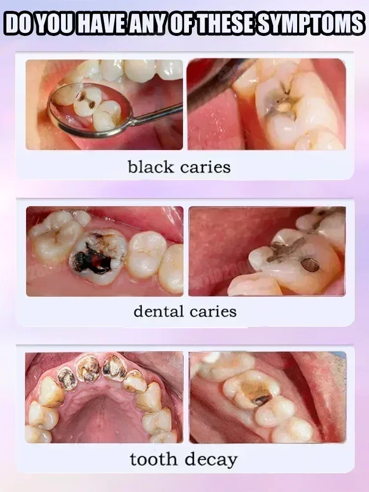 Penjualan terlaris terlaris, p - Teeth Whitening Treatment ulasan dan harga