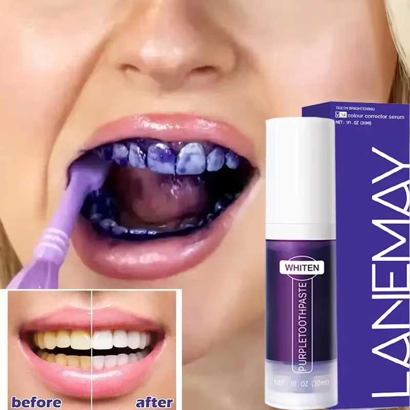 V34 pasta gigi ungu pemutih gi - Teeth Whitening Mousse ulasan dan harga