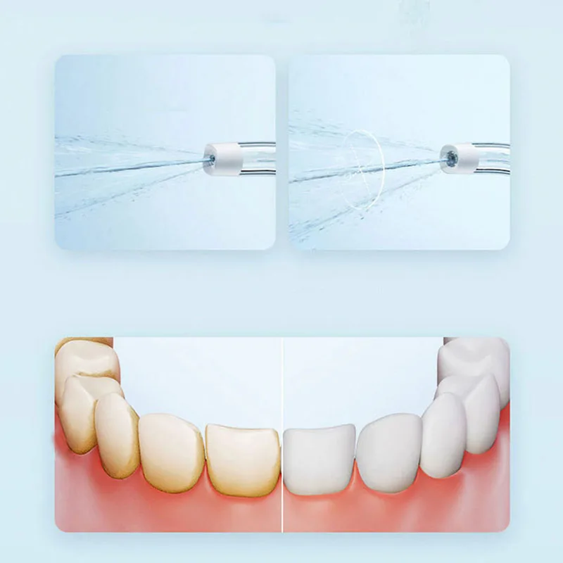 Xiaomi Irigator Mulut Portabel - Teeth Whitening Quick ulasan dan harga