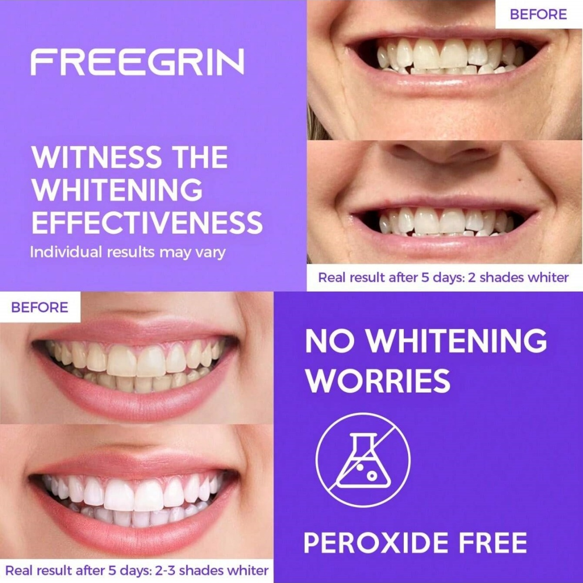 Stiker Gigi Pemutih Mewah 7/14 - Teeth Whitening Gel Refills ulasan dan harga