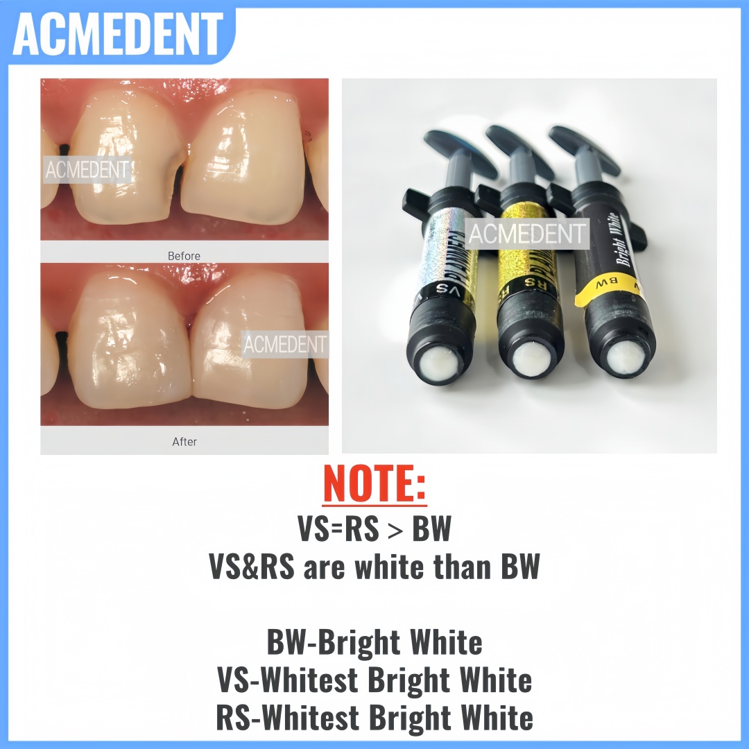 4.5G Alat Kedokteran Gigi Rest - Teeth Whitening Vs Veneers ulasan dan harga