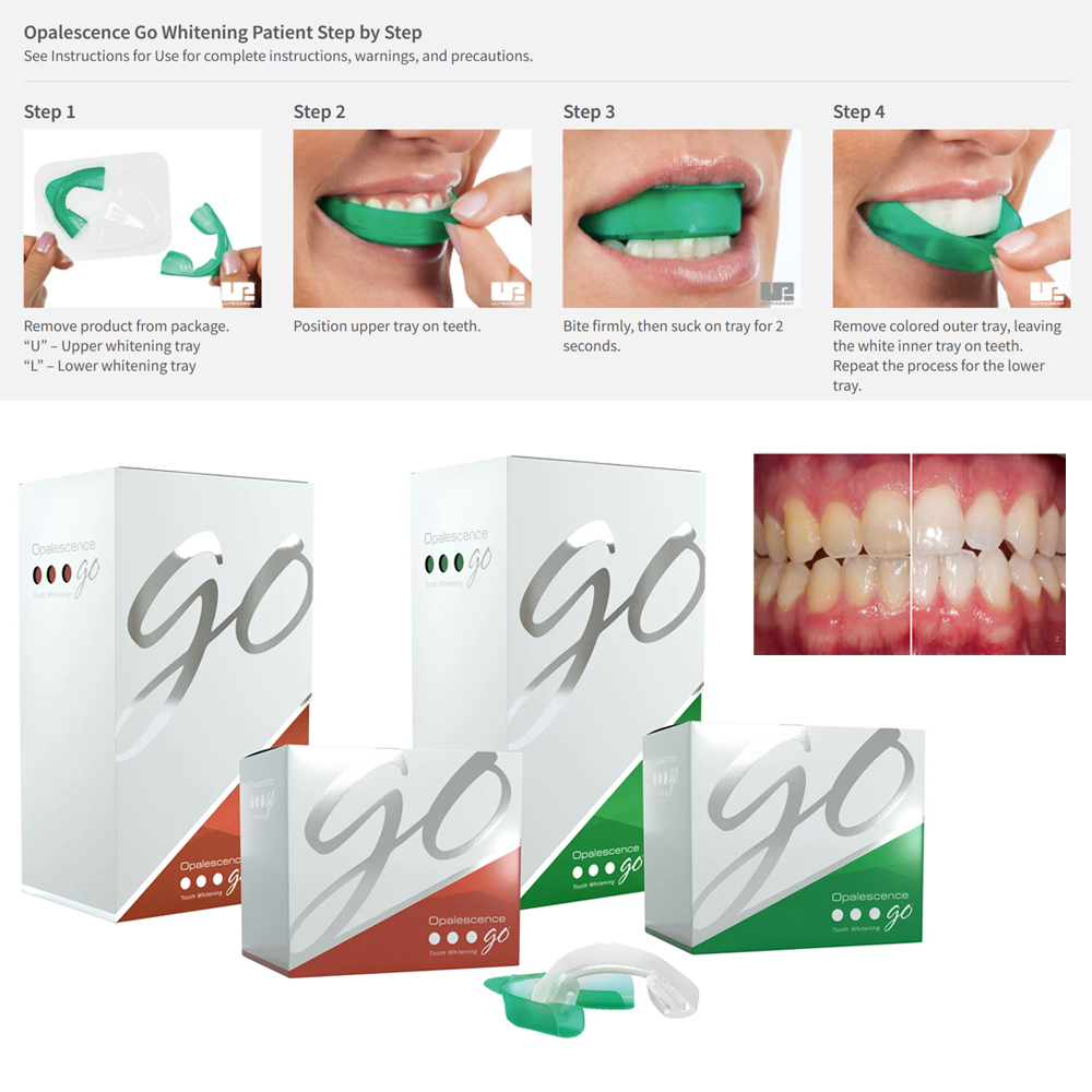 Opalesens Go Dental pemutih na - Teeth Whitening Opalescence Go ulasan dan harga