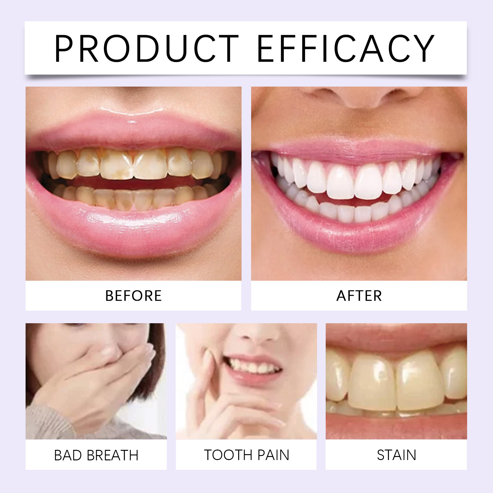 7 Buah Stiker Pembersih Gigi P - Teeth Whitening Gel Refills ulasan dan harga
