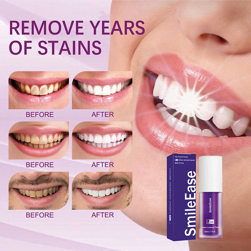 45ml Smilekit Purple Tooth Mou - Teeth Whitening Mousse ulasan dan harga