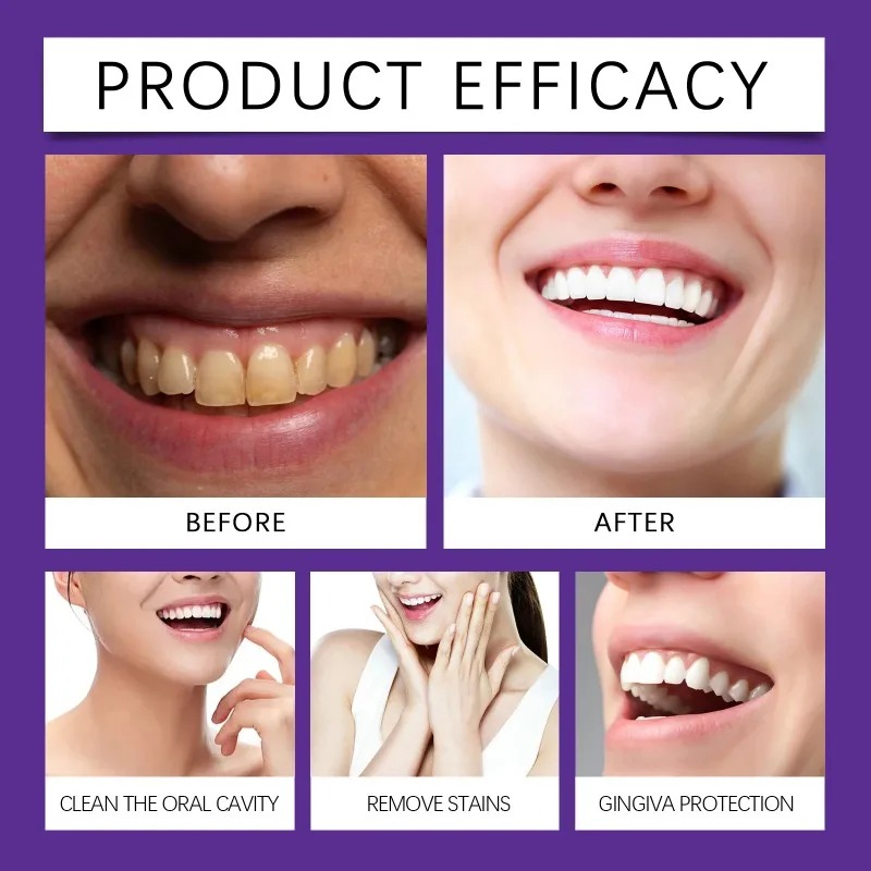 Bubuk Mineral Restorasi Gigi U - Teeth Whitening App ulasan dan harga