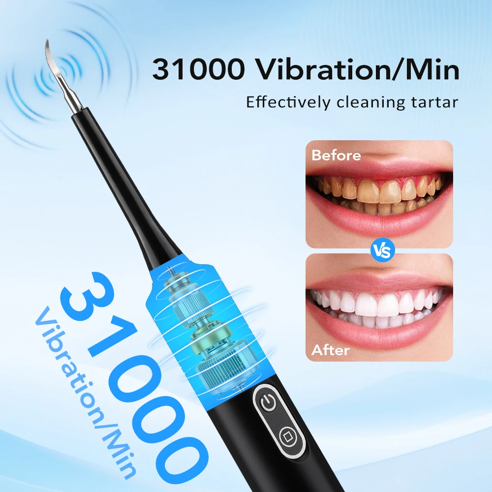 Alat Pembersih Karang Gigi Ele - Teeth Whitening Mouthwash ulasan dan harga