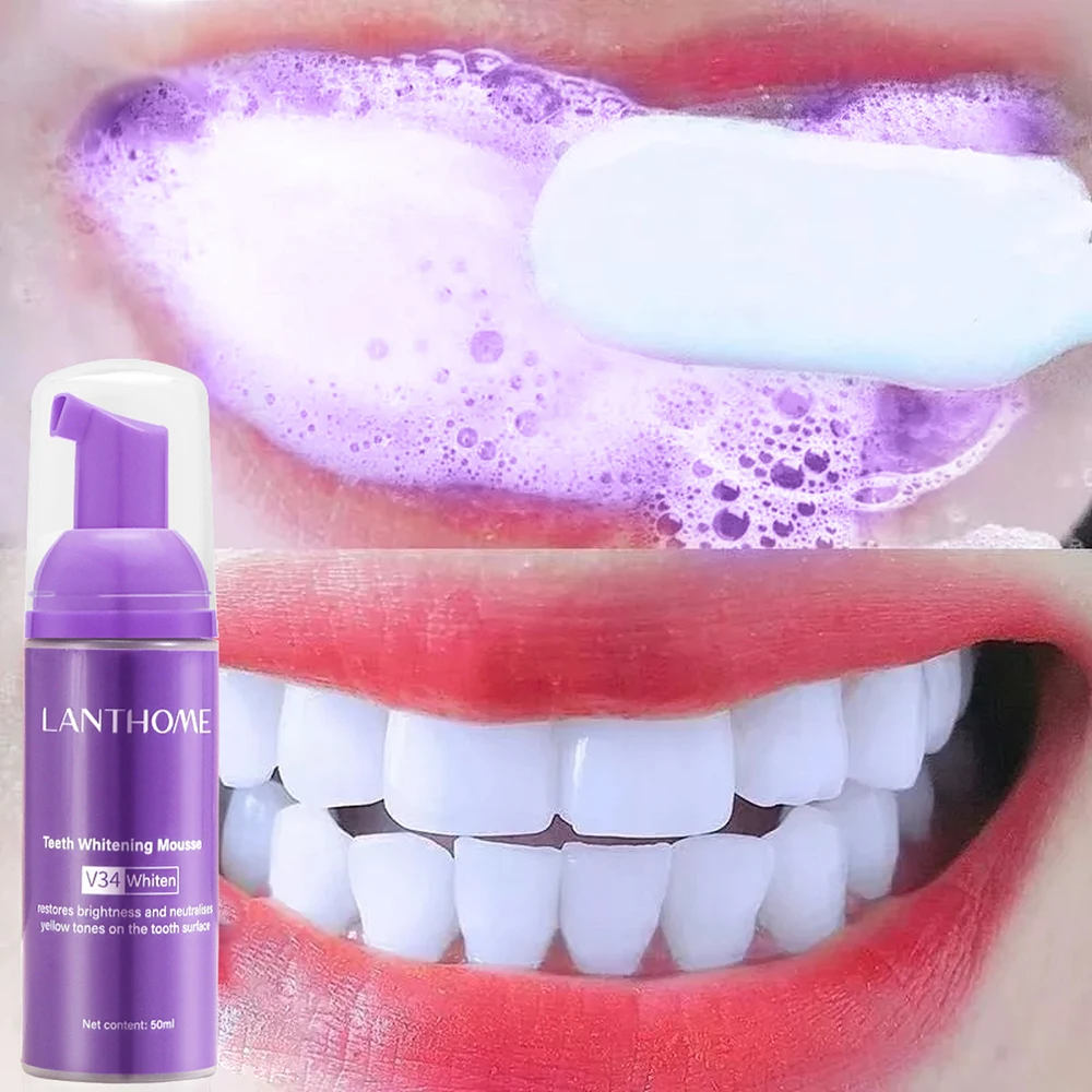 Mousse pasta gigi V34 pembersi - Teeth Whitening Mousse ulasan dan harga